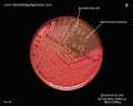 escherichia coli
